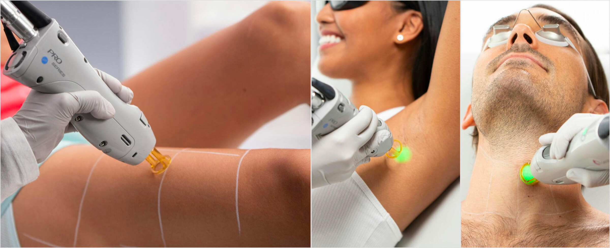 Laser hair removal treatments being performed on different body areas, including legs, underarms, and neck